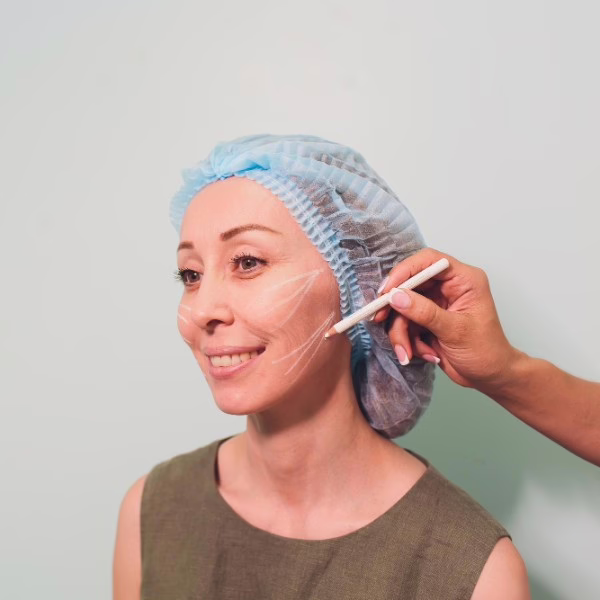 threadlift-procedure